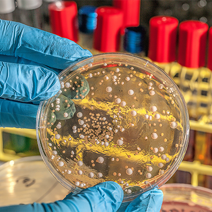 Sláinte agus Rialú Galar